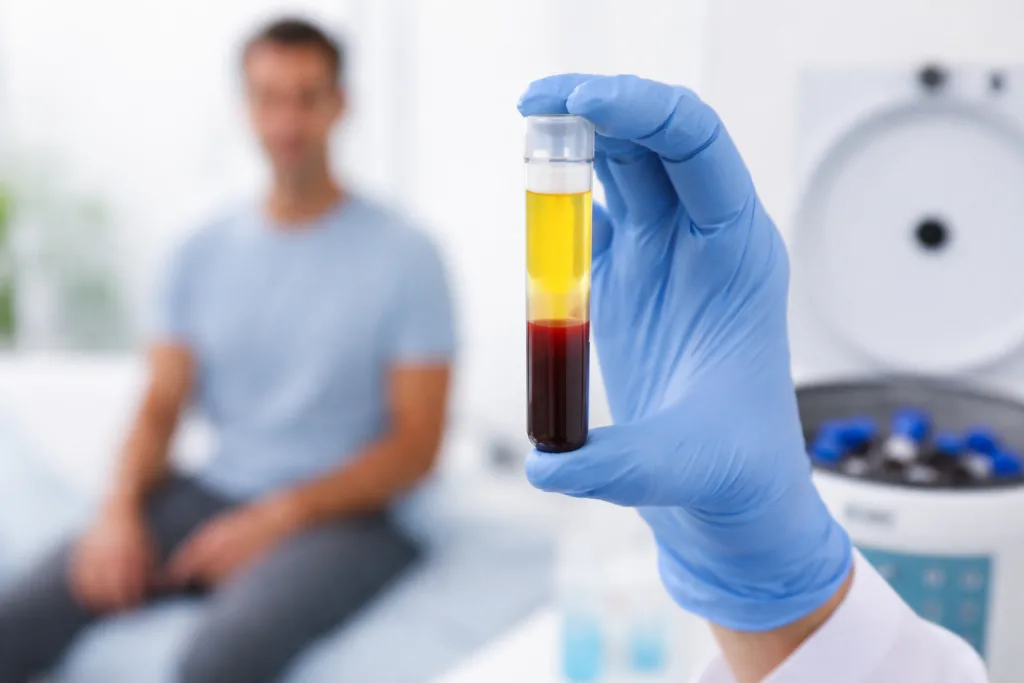 Platelet Rich Plasma Injections Jacksonville FL